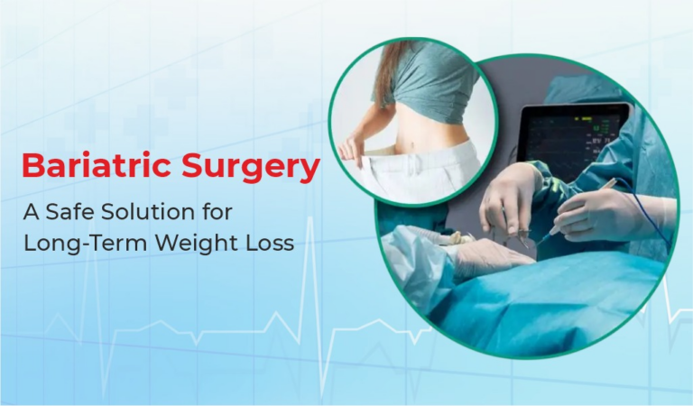 Bariatric Surgery: A Safe Solution for Long-Term Weight Loss