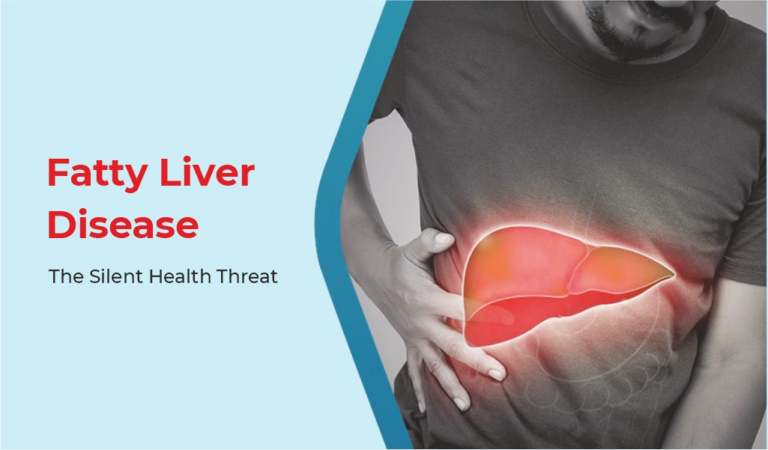 Fatty Liver Disease: The Silent Health Threat